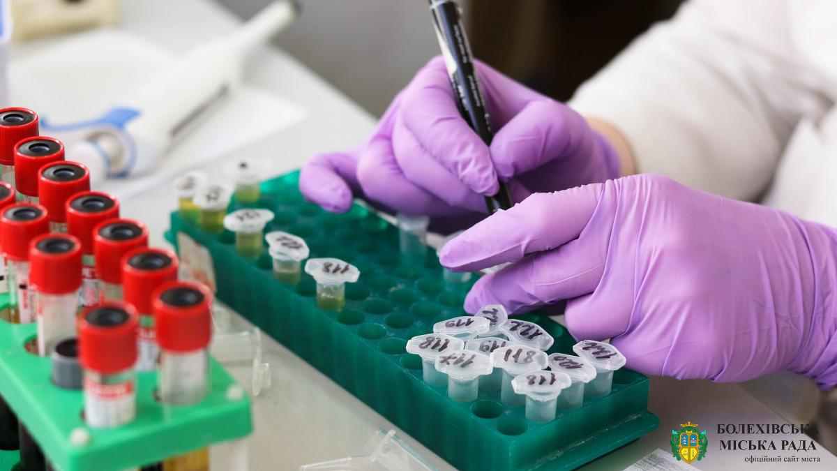 Україна отримала тест-систему для виявлення нового коронавірусу