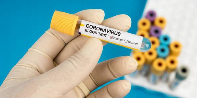 Ризики захворіти на COVID-19 можна оцінити, пройшовши онлайн-тестування