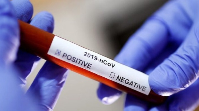 Впродовж доби на Прикарпатті зафіксували 40 нових випадків поширення коронавірусної інфекції, семеро осіб одужали