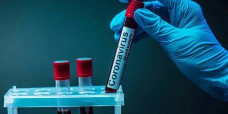 За минулу добу в області підтвердили 169 нових випадків коронавірусної хвороби