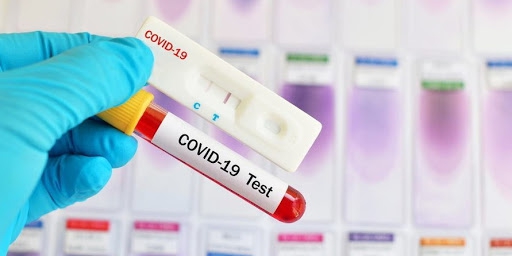 За минулу добу на Прикарпатті – 134 нові випадки коронавірусної інфекції