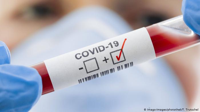 За минулу добу на Прикарпатті виявили 433 нових хворих на COVID-19