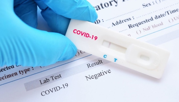 Коли варто робити тест на COVID-19?